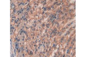Used in DAB staining on fromalin fixed paraffin- embedded Kidney tissue (SHISA4 抗体  (AA 28-197))
