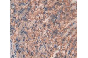 Used in DAB staining on fromalin fixed paraffin- embedded Kidney tissue (SHISA4 抗体  (AA 28-197))