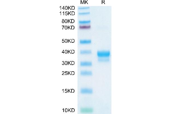 IgE Protein (AA 208-429) (His-Avi Tag)