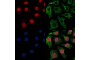 MYEOV Antibody staining HepG2 cells by IF/ICC. (MYEOV 抗体  (Internal Region))