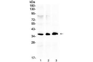 Western blot testing of human 1) HeLa, 2) COLO320 and 3) SW620 cell lysate with AKR1B10 antibody at 0. (AKR1B10 抗体  (AA 285-316))