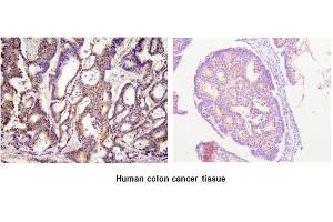 Immunohistochemistry (IHC) image for anti-Acyl-CoA Thioesterase 11 (ACOT11) (AA 19-250) antibody (ABIN317516) (ACOT11 抗体  (AA 19-250))