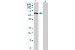 Western Blot analysis of ST8SIA2 expression in transfected 293T cell line by ST8SIA2 MaxPab polyclonal antibody. (ST8SIA2 抗体  (AA 1-354))