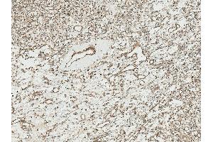 Immunohistochemistry analysis using Rabbit Anti-TCF4 Polyclonal Antibody (ABIN5650930). (TCF4 抗体  (AA 500-600) (FITC))