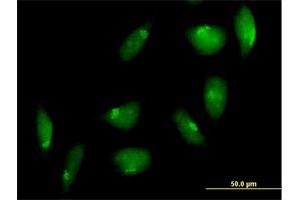 Immunofluorescence of purified MaxPab antibody to TTK on HeLa cell. (Mps1 抗体  (AA 1-857))