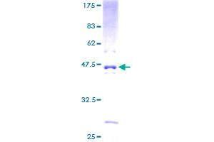 ALKBH3 Protein (AA 1-139) (GST tag)