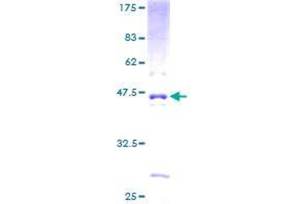 ALKBH3 Protein (AA 1-139) (GST tag)