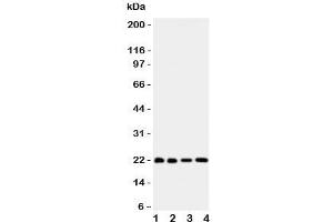 Western blot testing of Bid antibody and Lane 1:  HeLa;  2: COLO320;  3: Jurkat;  4: SKOV lysate. (BID 抗体  (AA 1-195))