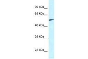 Image no. 1 for anti-Eyes Absent Homolog 2 (Drosophila) (EYA2) (AA 200-249) antibody (ABIN6747418) (EYA2 抗体  (AA 200-249))