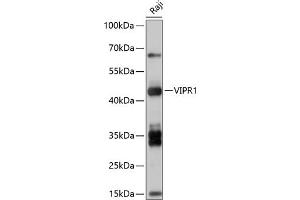 Western blot analysis of extracts of Raji cells, using VIPR1 antibody (ABIN7271299) at 1:1000 dilution. (VIPR1 抗体  (AA 31-150))