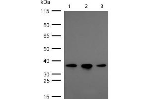 All lanes : OXGR1 Rabbit mAb at 1/1k dilution Lane 1 : Hela whole cell lysates Lane 2 : A549 whole cell lysates Lane 3 : HUVEC whole cell lysates Lysates/proteins at 20 μg per lane. (Recombinant OXGR1 抗体)