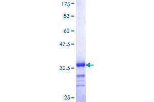 RBM39 Protein (AA 423-472) (GST tag)