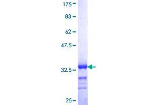 RBM39 Protein (AA 423-472) (GST tag)