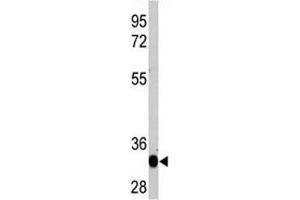 Western blot analysis of recombinant protein with LIN28A antibody (LIN28A 抗体)