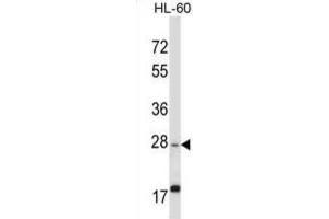 Western Blotting (WB) image for anti-Apolipoprotein O-Like (APOOL) antibody (ABIN2997795) (APOOL 抗体)