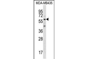 Western blot analysis in MDA-MB435 cell line lysates (35ug/lane). (Fascin 3 抗体  (C-Term))