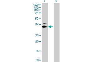 Western Blot analysis of KIAA0247 expression in transfected 293T cell line by KIAA0247 MaxPab polyclonal antibody. (SUSD6/KIAA0247 抗体  (AA 1-303))