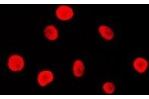 Immunofluorescent analysis of MSH2 staining in Hela cells. (MSH2 抗体)