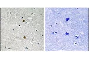 Immunohistochemistry analysis of paraffin-embedded human brain tissue, using NF-kappaB p65 (Ab-281) Antibody.