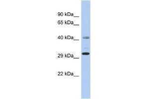 WB Suggested Anti-C11orf46 Antibody Titration: 0. (C11orf46 抗体  (N-Term))