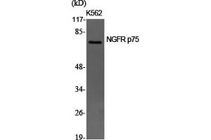 Western Blotting (WB) image for anti-Nerve Growth Factor Receptor (NGFR) (Internal Region) antibody (ABIN5956122) (NGFR 抗体  (Internal Region))