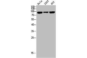 Western Blot analysis of HELA 293T 453 cells using Phospho-GR (S203) Polyclonal Antibody (Glucocorticoid Receptor 抗体  (pSer203))