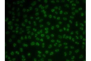 Immunofluorescence analysis of MCF7 cells using KHDRBS3 antibody (ABIN6131841, ABIN6142833, ABIN6142834 and ABIN6222332). (KHDRBS3 抗体  (AA 177-346))