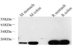 Western Blot analysis of various samples using TAGLN Polyclonal Antibody at dilution of 1:600. (Transgelin 抗体)