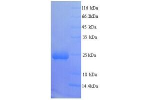 SDS-PAGE (SDS) image for BCL2/adenovirus E1B 19kDa Interacting Protein 3-Like (BNIP3L) (AA 1-219), (full length) protein (His tag) (ABIN5713284)