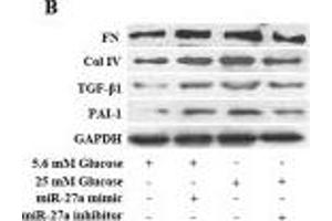 Western Blotting (WB) image for anti-Collagen, Type IV (COL4) (AA 1571-1669) antibody (ABIN707396)