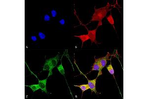 Immunocytochemistry/Immunofluorescence analysis using Mouse Anti-Ataxin 1 Monoclonal Antibody, Clone S76-8 (ABIN1741210). (Ataxin 1 抗体  (AA 164-197) (HRP))