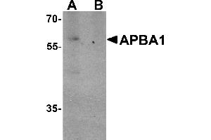 Western blot analysis of APBA1 in rat brain tissue lysate with APBA1 antibody at 0.