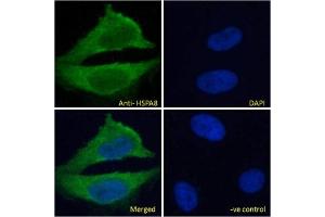 IF/ICC testing of fixed and permeabilized human HeLa cells with HSPA8 antibody (green) at 10ug/ml and DAPI nuclear stain (blue). (Hsc70 抗体)