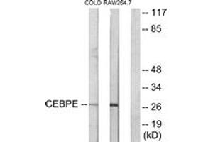 Western blot analysis of extracts from LOVO/RAW264. (CEBPD, CEBPE 抗体  (AA 171-220))