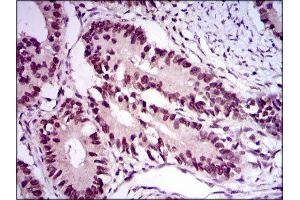Immunohistochemistry (IHC) image for anti-E2F Transcription Factor 1 (E2F1) (AA 69-223) antibody (ABIN1845545) (E2F1 抗体  (AA 69-223))