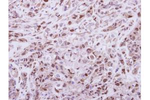 IHC-P Image Immunohistochemical analysis of paraffin-embedded H661 xenograft, using DPF2, antibody at 1:250 dilution. (DPF2 抗体  (Center))