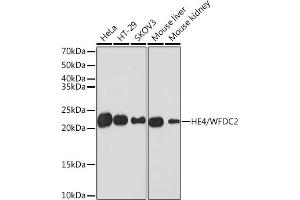 Western blot analysis of extracts of various cell lines, using HE4/WFDC2 Rabbit mAb (ABIN1682653, ABIN3017632, ABIN3017633 and ABIN7101513) at 1:1000 dilution. (WFDC2 抗体)