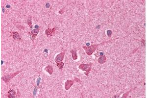 Human Brain, Cortex (formalin-fixed, paraffin-embedded) stained with BCL10 antibody ABIN214608 at 10 ug/ml followed by biotinylated goat anti-rabbit IgG secondary antibody ABIN481713, alkaline phosphatase-streptavidin and chromogen. (BCL10 抗体  (AA 5-19))