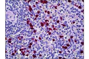 Human Spleen: Formalin-Fixed, Paraffin-Embedded (FFPE) (HGS 抗体  (Internal Region))