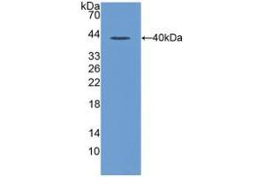 Western blot analysis of recombinant Rat MIP1a. (CCL3 抗体  (AA 24-92))