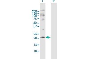 Western Blot analysis of ANAPC10 expression in transfected 293T cell line by ANAPC10 MaxPab polyclonal antibody. (ANAPC10 抗体  (AA 1-185))