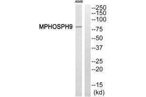 Western blot analysis of extracts from A549 cells, using MPHOSPH9 antibody. (KIF2B 抗体  (C-Term))