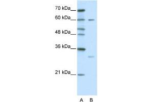 WB Suggested Anti-ZNF395 Antibody Titration:  0. (ZNF395 抗体  (C-Term))
