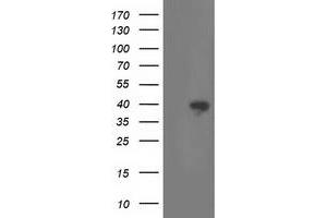 Western Blotting (WB) image for anti-Retinaldehyde Binding Protein 1 (RLBP1) antibody (ABIN1497623) (RLBP1 抗体)