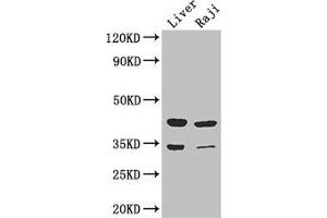 Western Blot Positive WB detected in: Mouse liver tissue, Raji whole cell lysate All lanes: BHMT2 antibody at 3 μg/mL Secondary Goat polyclonal to rabbit IgG at 1/50000 dilution Predicted band size: 41, 34 kDa Observed band size: 41, 34 kDa (BHMT2 抗体  (AA 1-200))