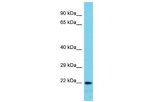 Host: Rabbit Target Name: CTAG1A Sample Type: HT1080 Whole Cell lysates Antibody Dilution: 1. (CTAG1A 抗体  (N-Term))