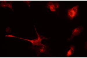 Immunofluorescence - anti-tdTomato Ab in 293HEK Cells transfected with cDNA at 1/50 dilution, cells were fixed with 4% of PFA, (tdTomato 抗体)