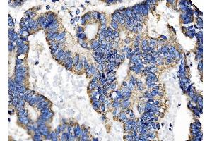 IHC analysis of TOMM70 using anti-TOMM70 antibody (ABIN7599855). (TOM70 抗体  (AA 122-608))