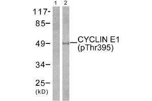 Western Blotting (WB) image for anti-Cyclin E1 (CCNE1) (pThr395) antibody (ABIN1847246) (Cyclin E1 抗体  (pThr395))