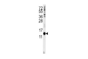Western blot analysis of anti-CDA Antibody (C-term) (ABIN389393 and ABIN2839485) in Hela cell line lysates (35 μg/lane). (CDA 抗体  (C-Term))